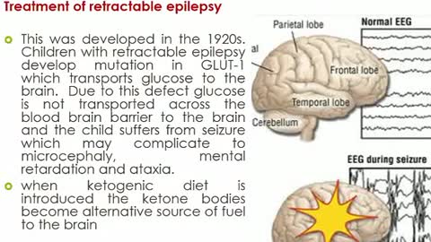 Benefits of ketogenic diet