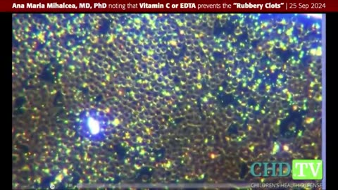 Vitamin C and EDTA can help halt ＂rubbery clots,＂ says Ana Maria Mihalcea, MD, PhD.