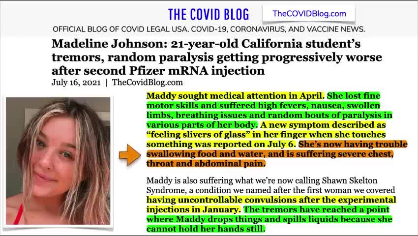 תגובות שליליות לחיסון לקורונה אצל נערה בת 21 שהולכים ומחמירים