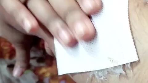 Arm waxing