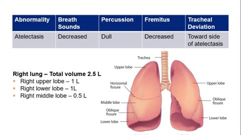 USMLE-Rx •Physical findings in select lung diseases