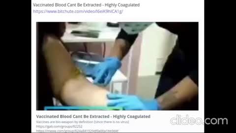 Global Adverse Reactions After Covid-19 VAXX