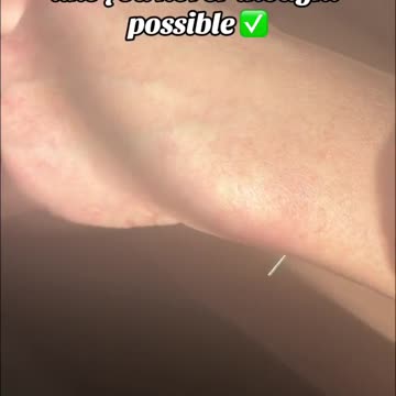 stimulate self healing now