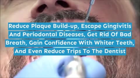 Review for Steel Bite Pro - Supplement for Gums and Teeth | Must Watch!