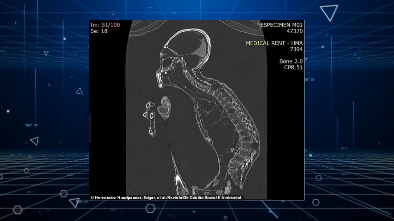 Decoding Maria: The 'Alien' Mummy's DNA & Anatomical Puzzles