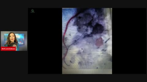 Remove The Nanoparticles From Your Body. Video & Photos For Proof.