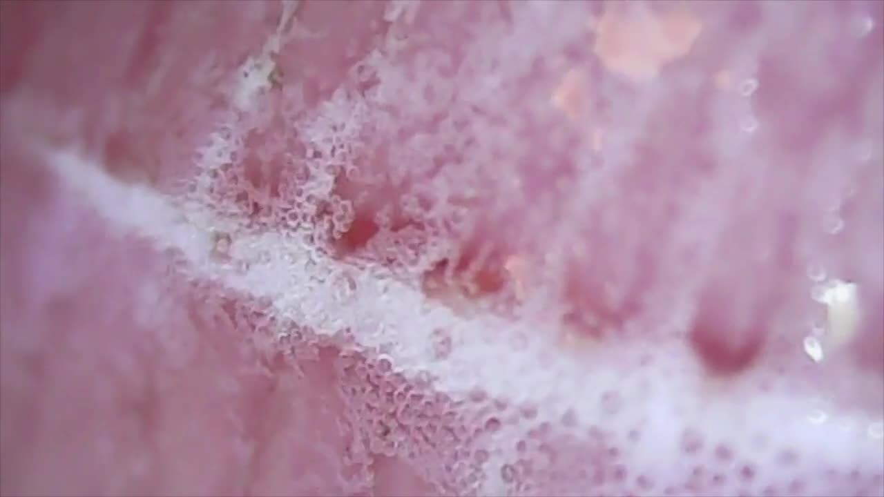 (GROSS) Adding Peroxide to an Accidental Finger Cut - Under Microscope