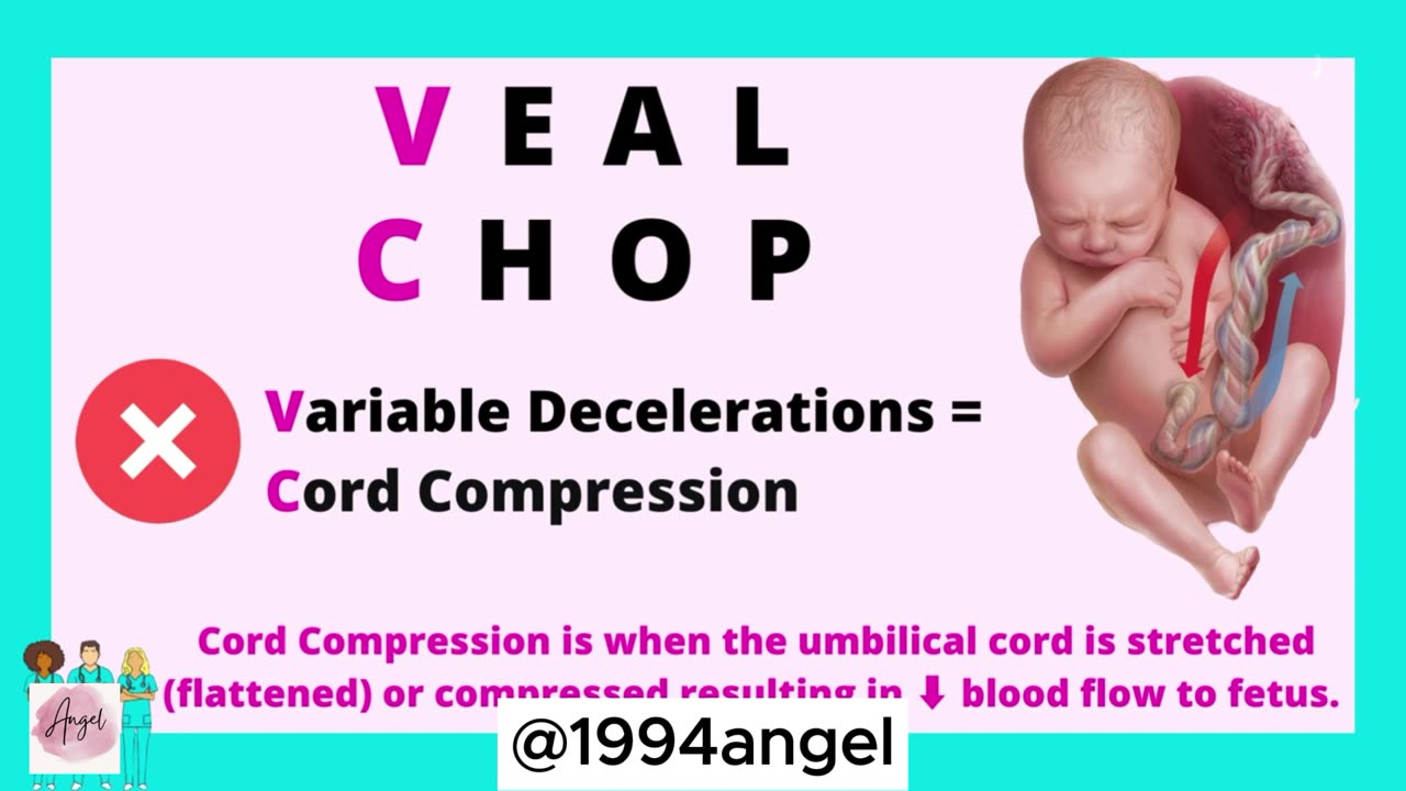 ✅ FHR Patterns & Veal Chop ✅ Explained in 5 Min or Less