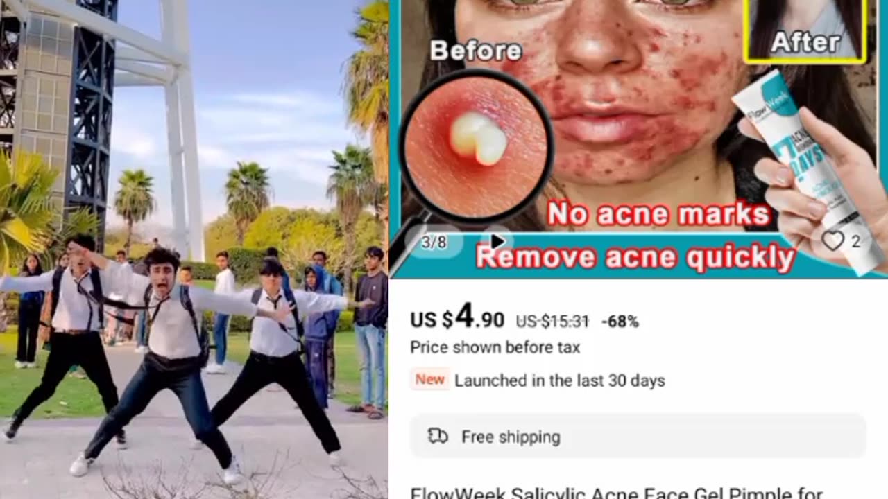 Acne Face Gel | Click to buy description link 👇