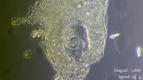 Watch an Amoeba eat paramecia