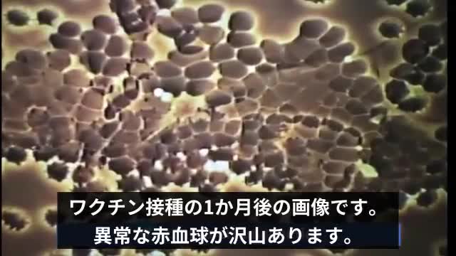 mRNA薬物(コロナワクチン)接種後に体内で引き起こされる現象。/モンタニエ理論 を 立証|ジェーンルビー博士