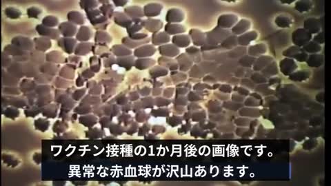 ｍRNA薬物（コロナワクチン）接種後に体内で引き起こされる現象。／モンタニエ理論 を 立証｜ジェーンルビー博士