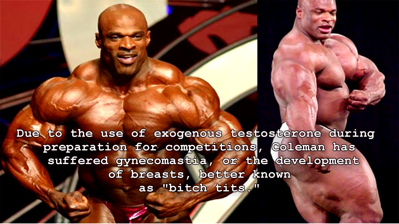 5 Disturbing Results Of steroids gone Wrong