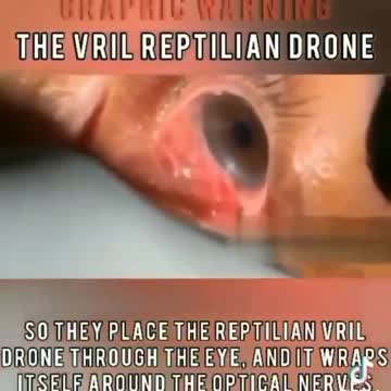 Implemention of the VRIL