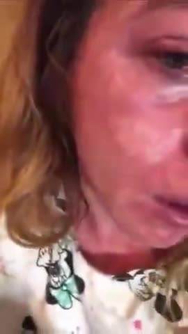 VACCINE INJURY ADVERSE EFFECTS PAINFUL SKIN ATTACK SYNDROME