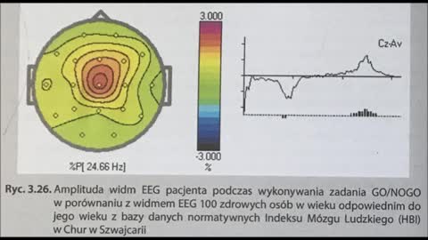 3.1 JA UTRACONE I ODZYSKANE 3.1 UDAR MÓZGU I ROZPAD SYSTEMU JA