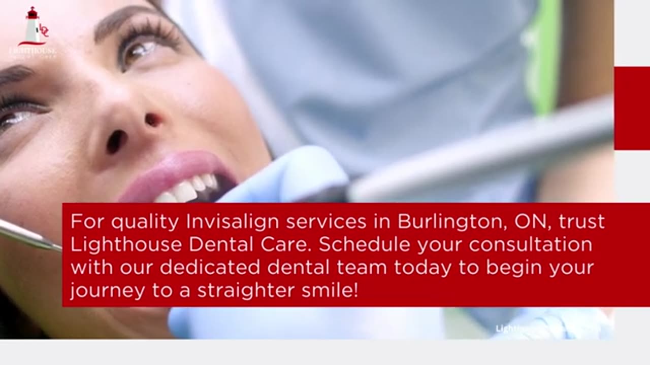 What You Should Know About Invisalign