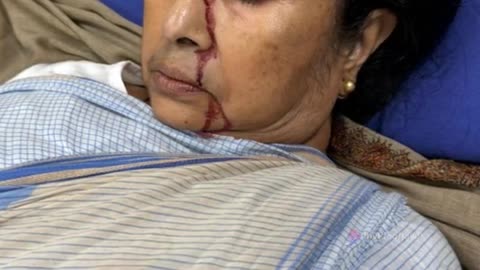 The Unfortunate Incident: Mamata Banerjee's Major Injury