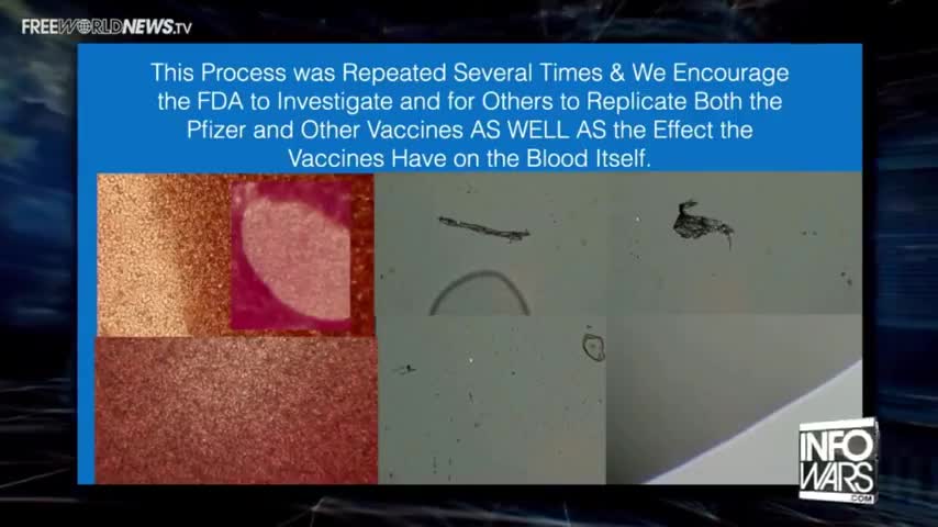 DISCOLORED RED BLOOD CELLS DUE TO VAX