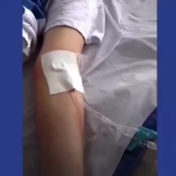 Adverse Reaction 1176 - Jab = poison - Chance of dying from the virus for a kid is ZERO - STUPIDITY