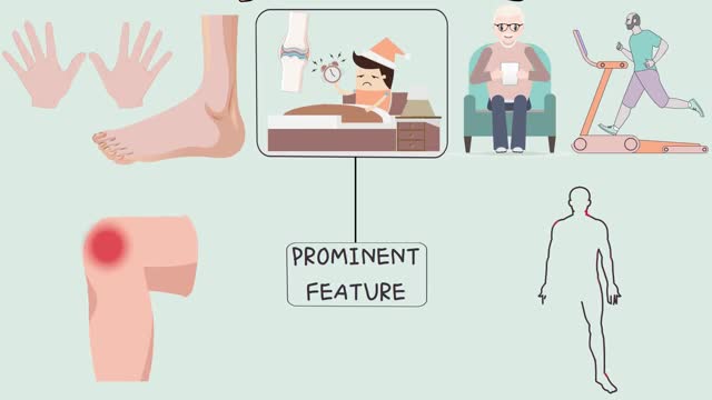 HOW TO TREAT RHEUMATOID ARTHIRITIS. RA Signs and Symptoms and Management