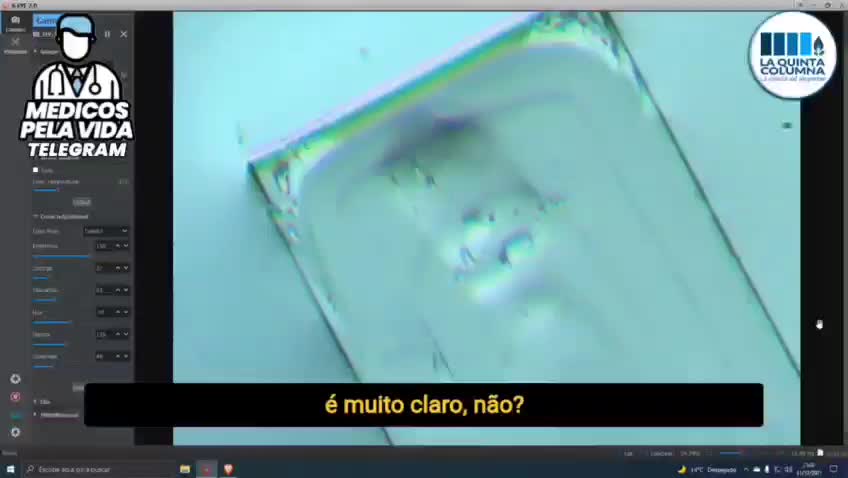 imagens de microscopia óptica do conteúdo da inoculação Pfisser