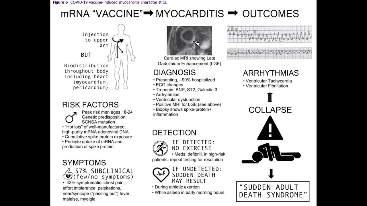 Myocarditis and the Jab , Doctors reveal study results