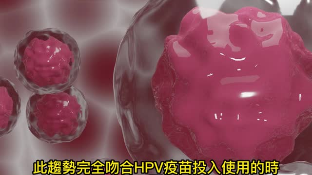 美國癌症死亡率 30年來下降33%