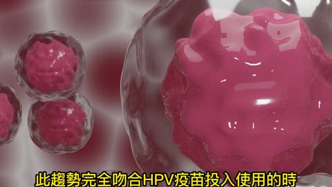 美國癌症死亡率 30年來下降33%