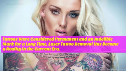 Tips to Know How to Remove Unwanted Tattoo