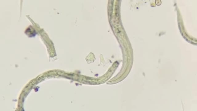 Microscope video of dirty water around us