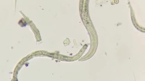 Microscope video of dirty water around us