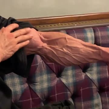 Check out this bodybuilder's arm the night before a competition