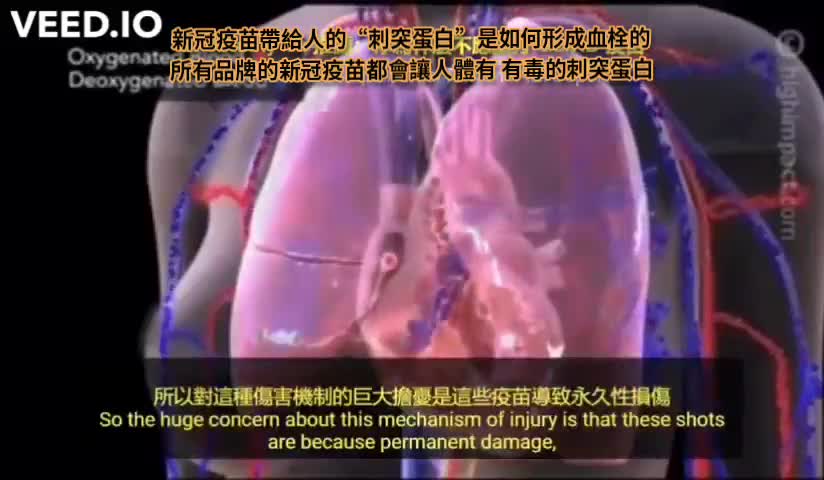 所有品牌的新冠疫苗都會讓人有血栓D-dimer能檢測微血栓
