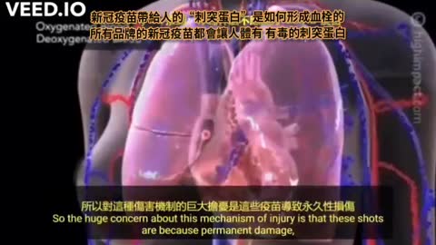 所有品牌的新冠疫苗都會讓人有血栓D-dimer能檢測微血栓
