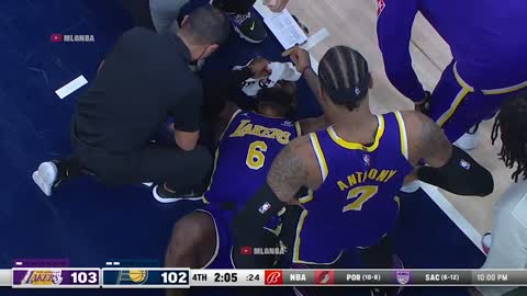 LeBron getting a cut above the eye after a foul from Sabonis