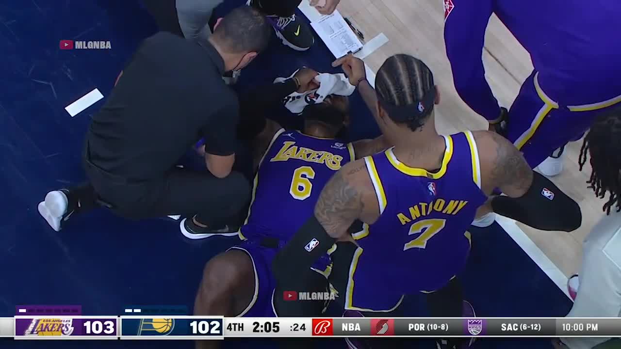 LeBron getting a cut above the eye after a foul from Sabonis