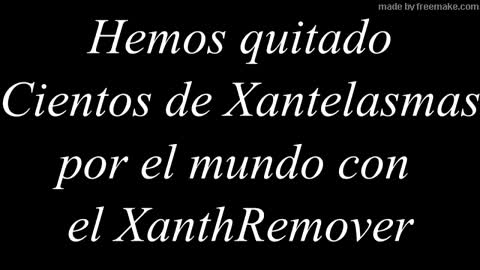 Testimonio de Sue, XanthRemover, Hoy quitar los Xantelasmas es muy facil