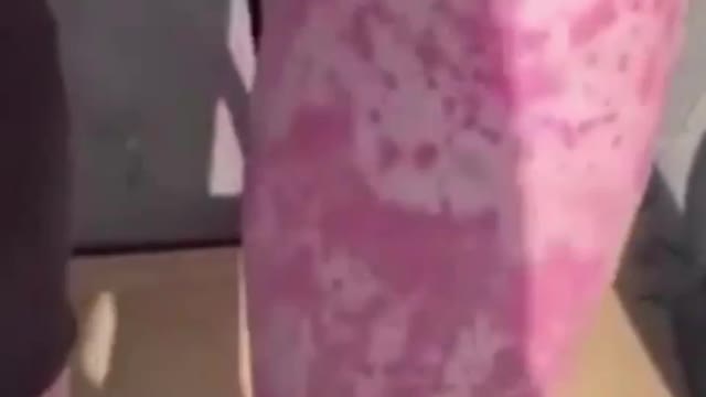 Courtney Keating’s veins burst and she ended up in a wheelchair