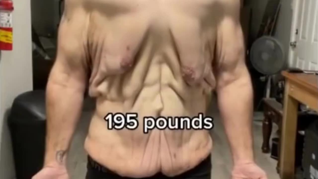 Weight Loss Transformation