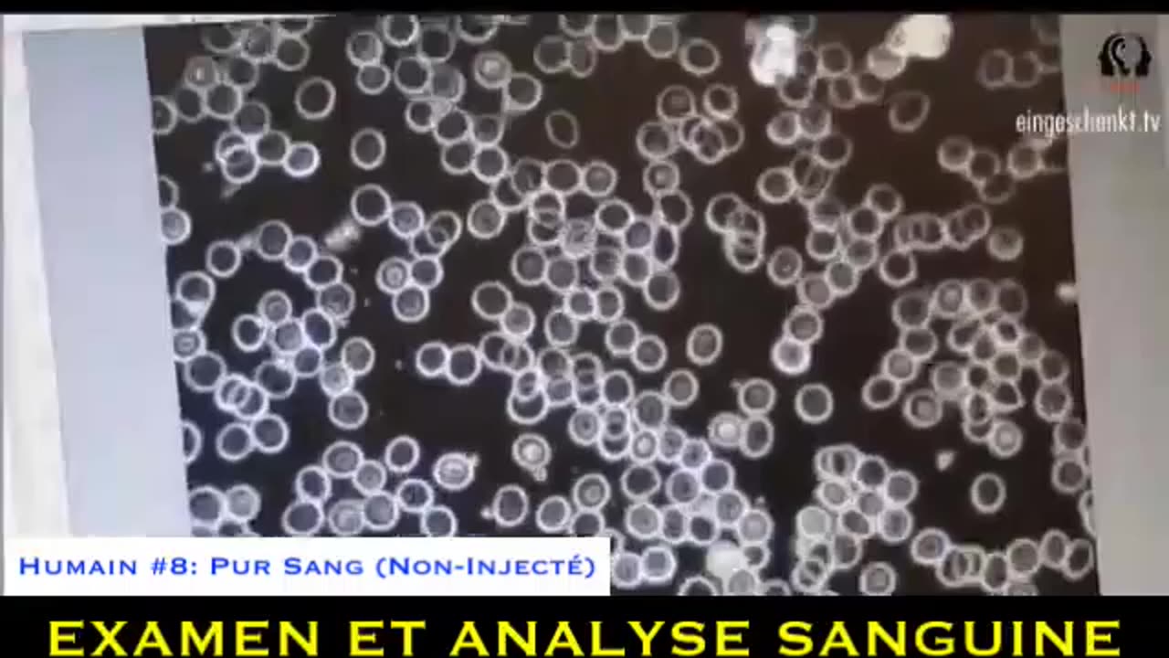 Krew po szczepieniach.
