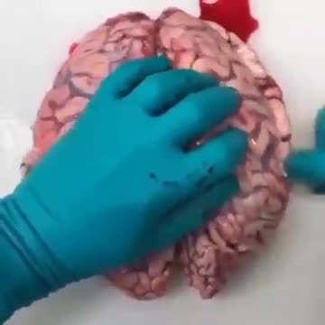 20211202_[펌] [★산화그래핀] [Right영어] (심장약하거나, 비위약하신분은 비추) 산화그래핀에 중독된 뇌