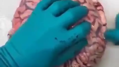 20211202_[펌] [★산화그래핀] [Right영어] (심장약하거나, 비위약하신분은 비추) 산화그래핀에 중독된 뇌