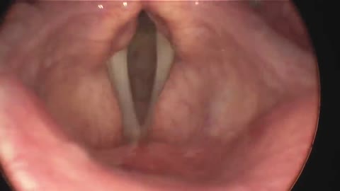 Vocal folds- Pitch Physics Demo