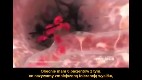 OSTRZEŻENIE! KATASTROFALNE SKUTKI STOSOWANIA SZCZEPIONEK MRNA