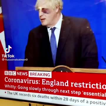 Boris Johnson with a black eye