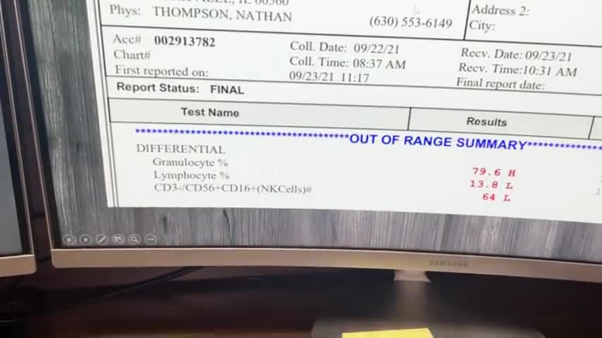 My Jaw DROPPED when I Tested Someone's Immune System After the 2nd Jab