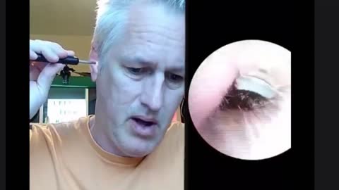 Kevin McCarthy Removing The Crap From His Ears