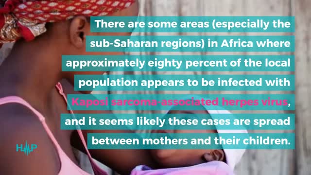 Causes And Risk Factors Of Kaposi's Sarcoma
