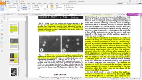 Virology 22: More Problems with Virus Isolation- the Electron Microscope Problem